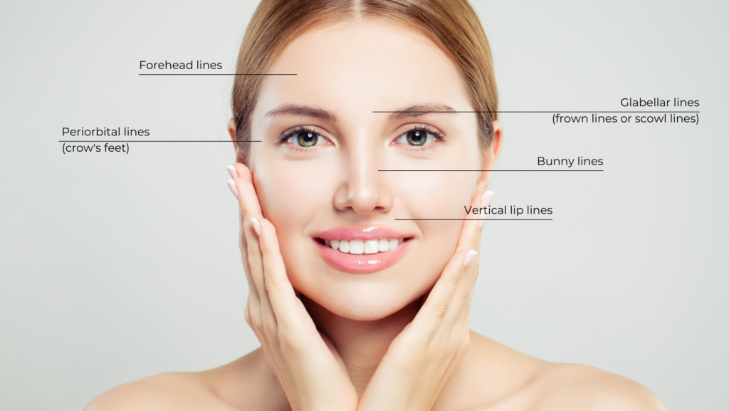 botox and dermal fillers chart 