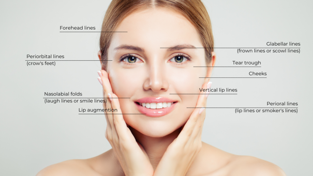botox and dermal fillers chart