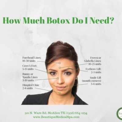 botox-dosage-700x600