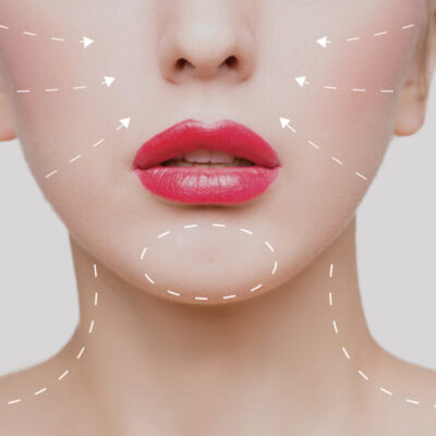 INJECTABLES-MAP-1024x683