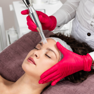 SkinPen Microneedling With Exosomes 75th Exclusive