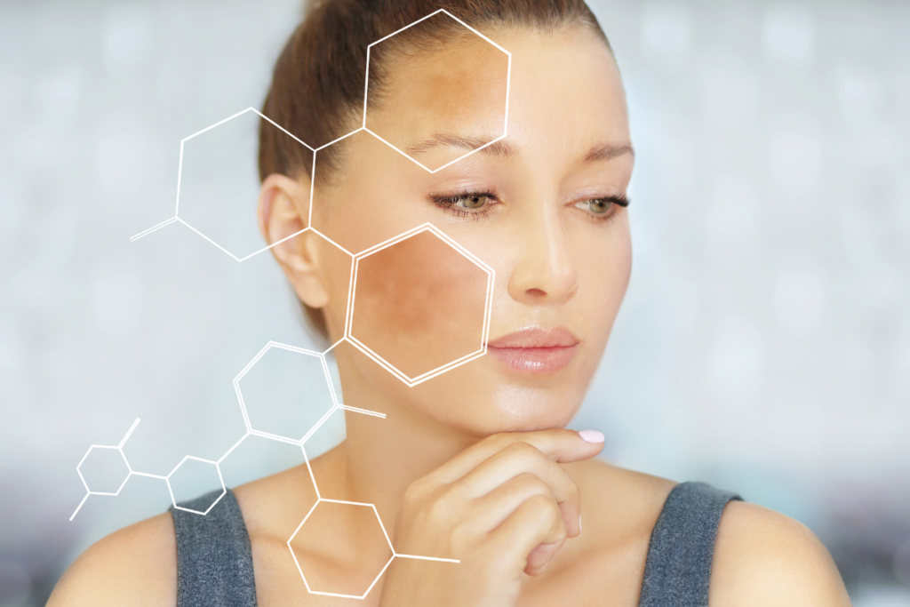 summer skin damage mcallen hyperpigmentation Beautique Medical Spa